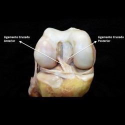 Reconstruções de lesões ligamentares